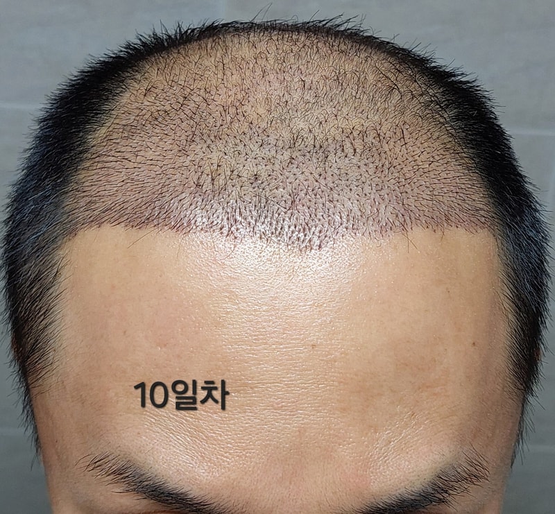 10일차2.jpg