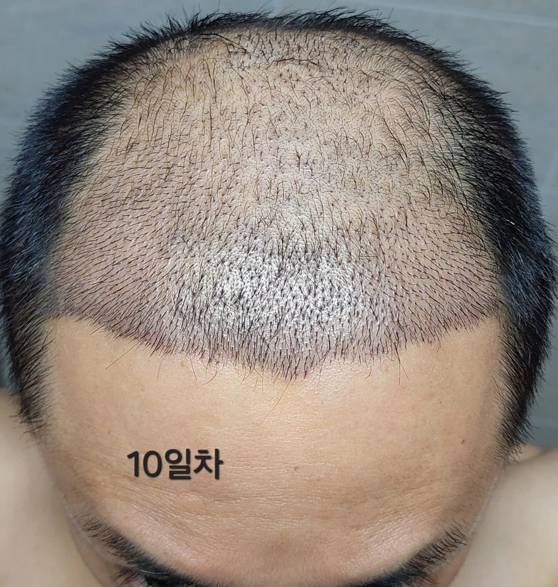 10일차1.jpg