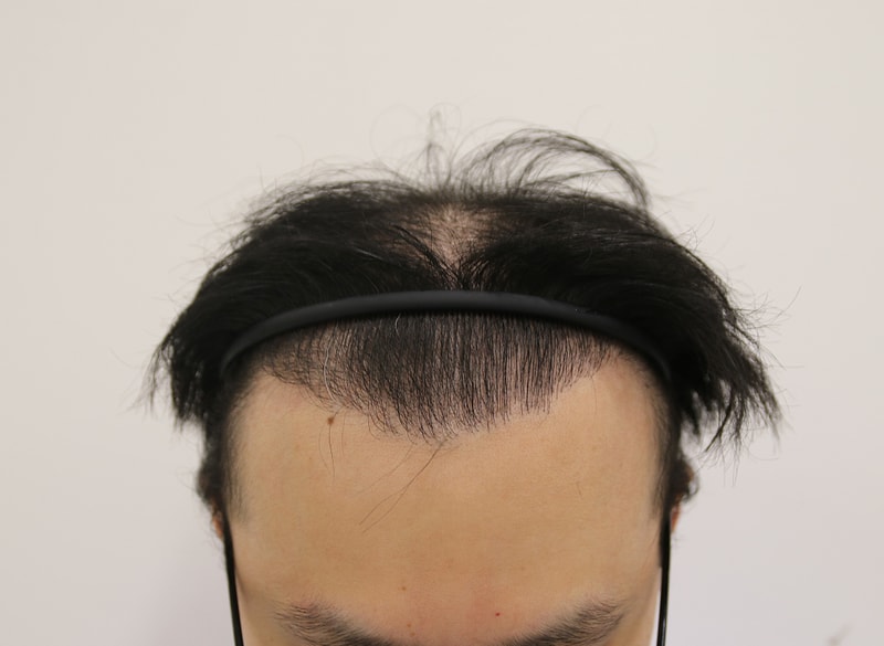 수술전2.jpg