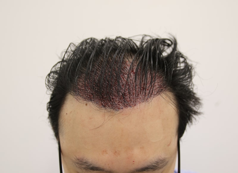 수술후.jpg