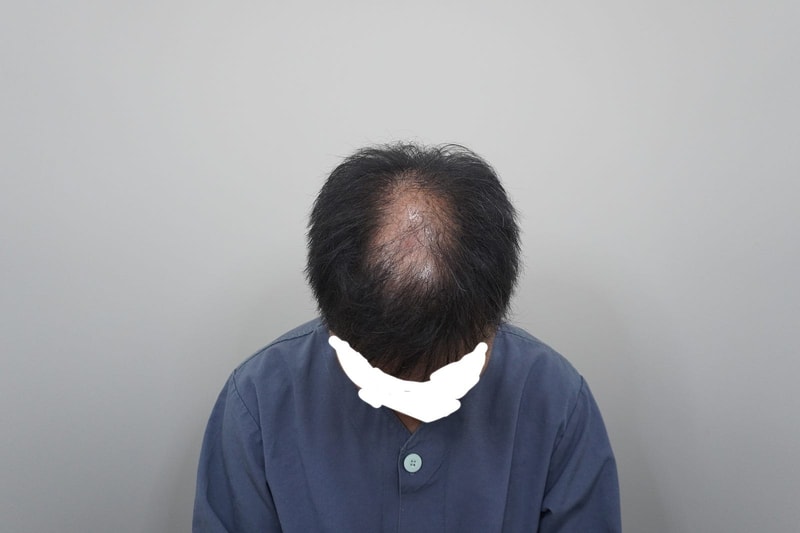 8월_15일(이식_전)_1.jpg