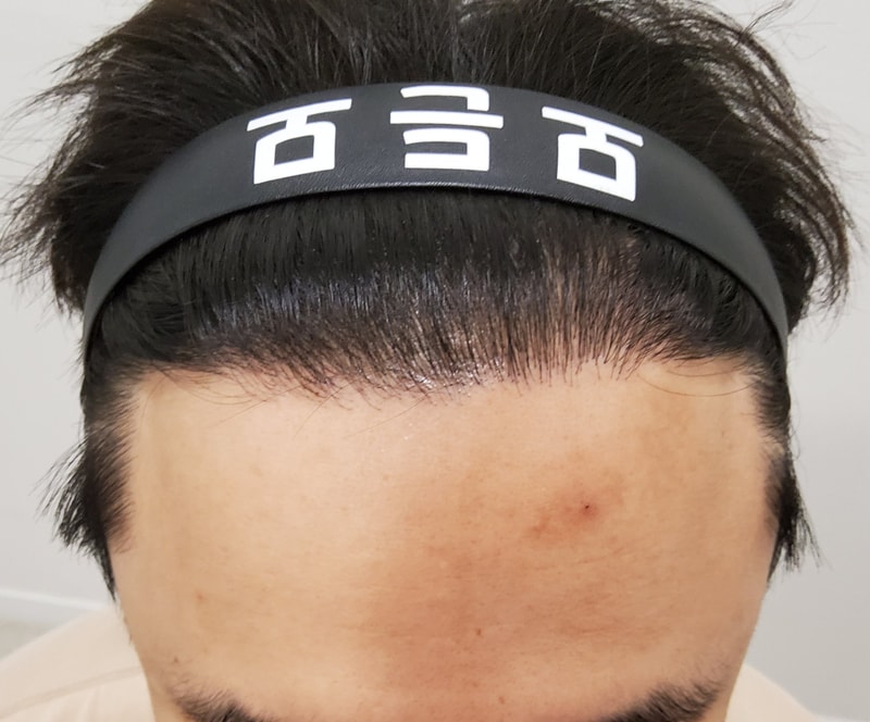 5. 수술후_1년_2.jpg