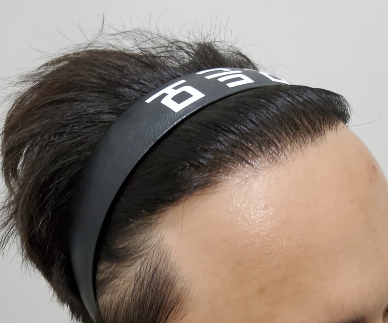 5. 수술후_1년_4.jpg