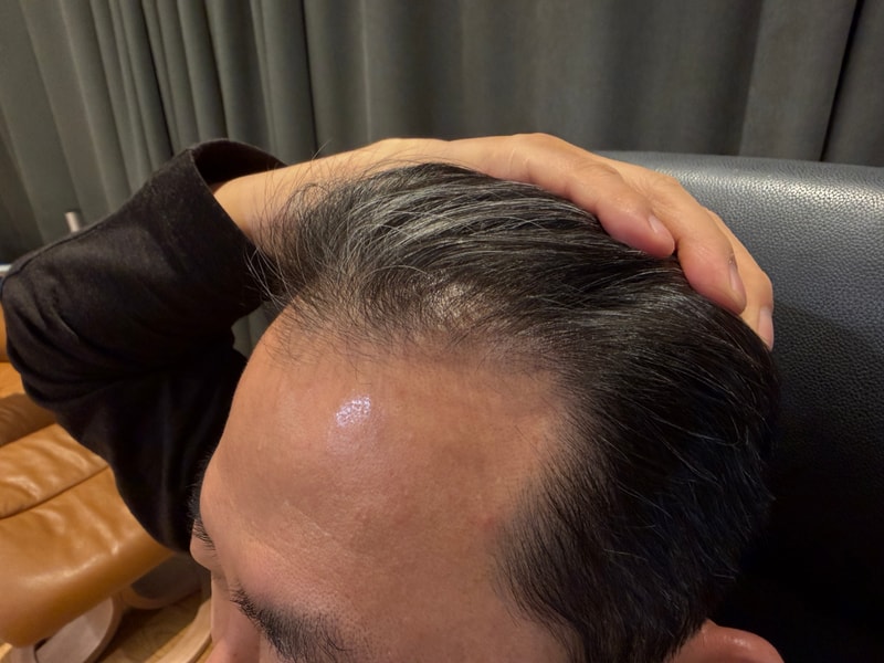 수술전 (3).jpg