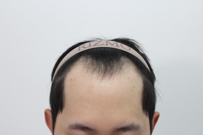 포토후기 이미지