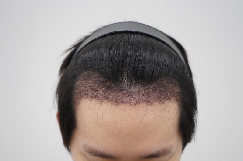 포토후기 이미지