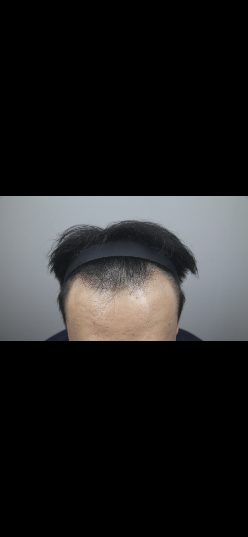 포토후기 이미지