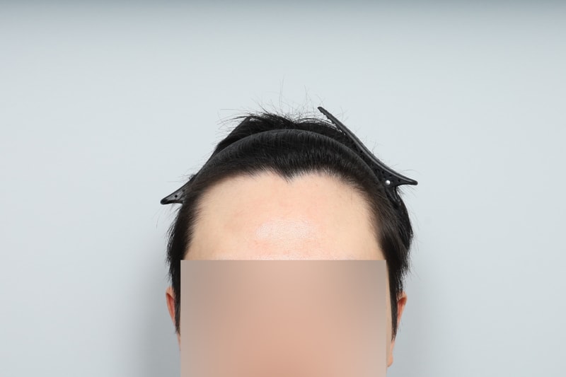 포토후기 이미지
