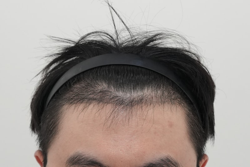 3개월암흑기.jpg