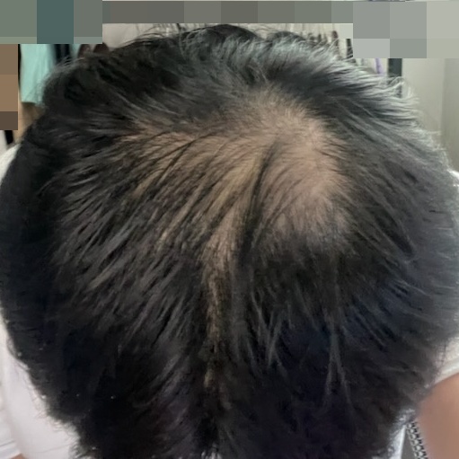 KakaoTalk_20260904_144843313_02_수술전.jpg