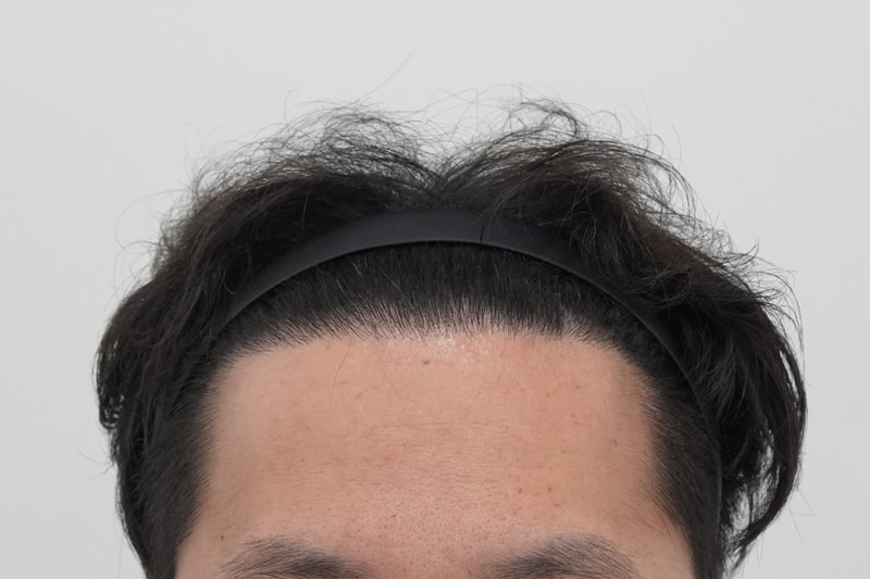 수술후.jpg