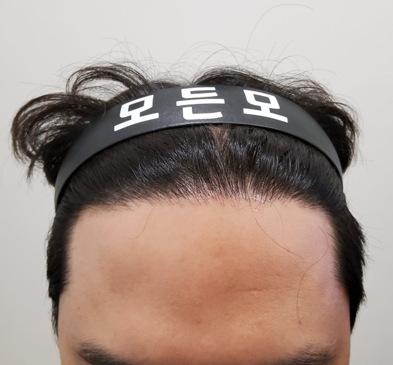 5. 수술후_1년_1.jpg