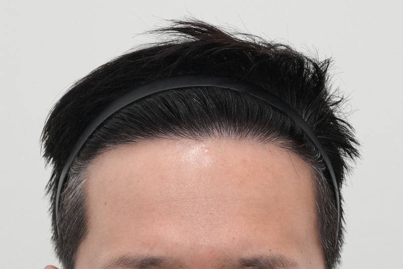 수술후.jpg