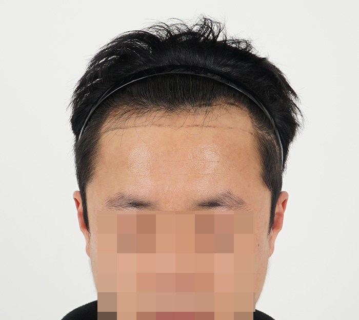 포토후기 이미지