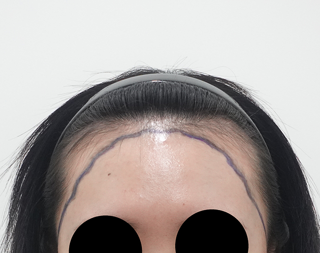 포토후기 이미지