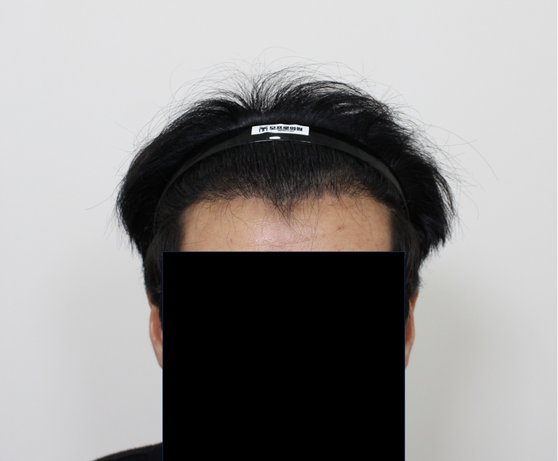 포토후기 이미지
