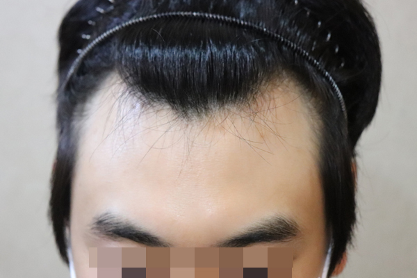 포토후기 이미지