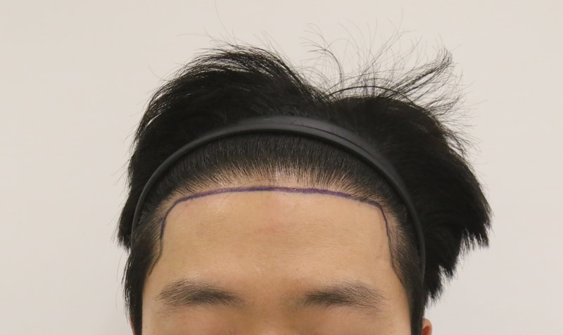 포토후기 이미지