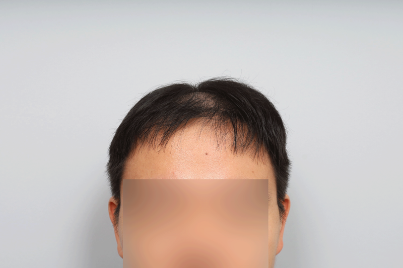 포토후기 이미지