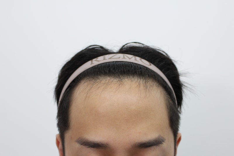 수술전1.jpg
