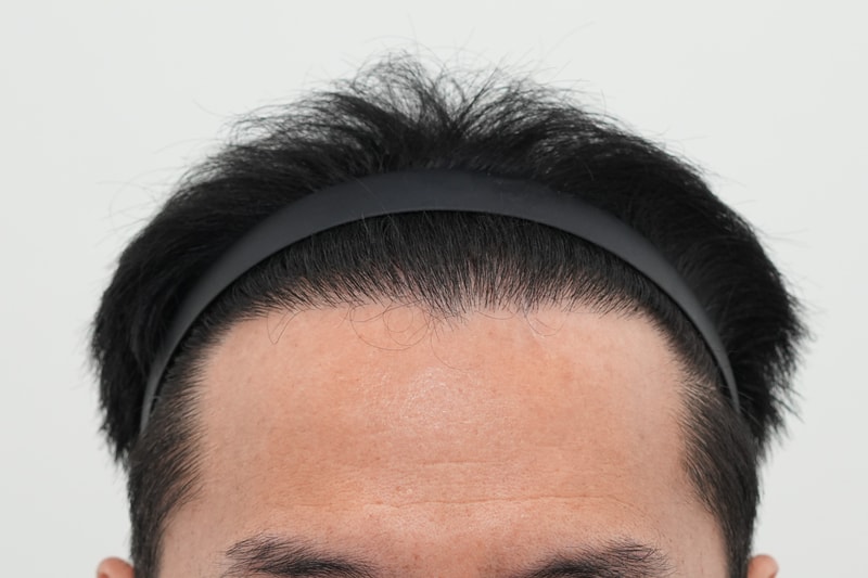 수술후.jpg