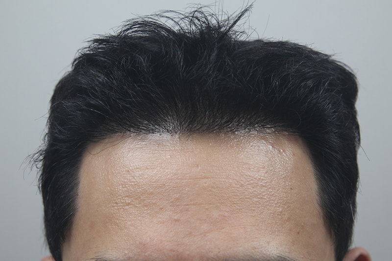 포토후기 이미지