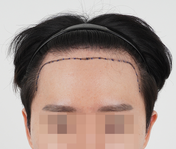 포토후기 이미지