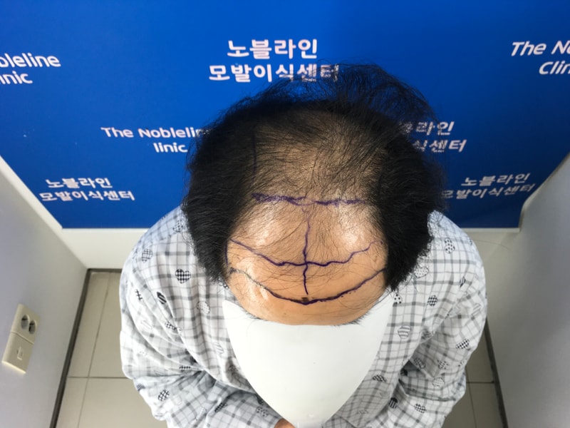 포토후기 이미지