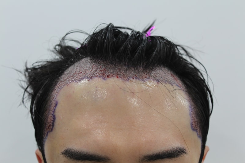 포토후기 이미지