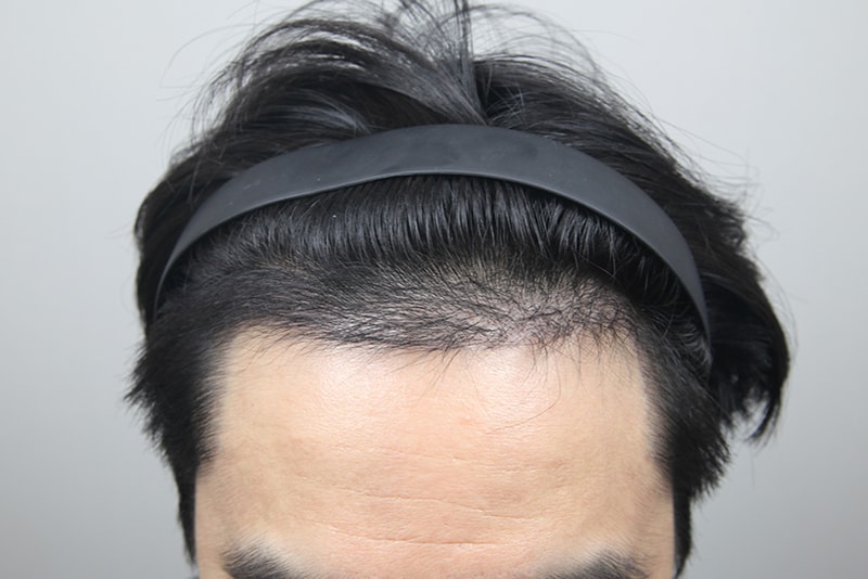 포토후기 이미지