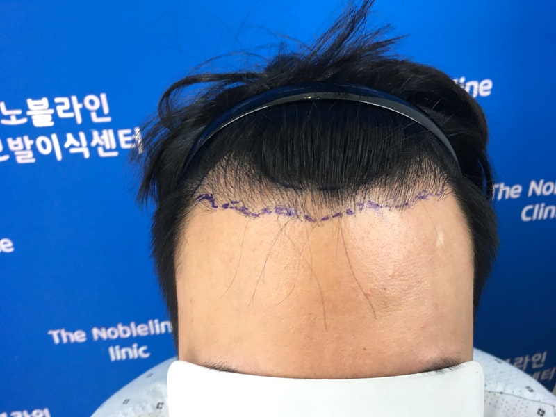 포토후기 이미지