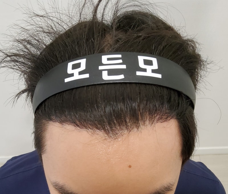 4. 수술후_1년_1.jpg