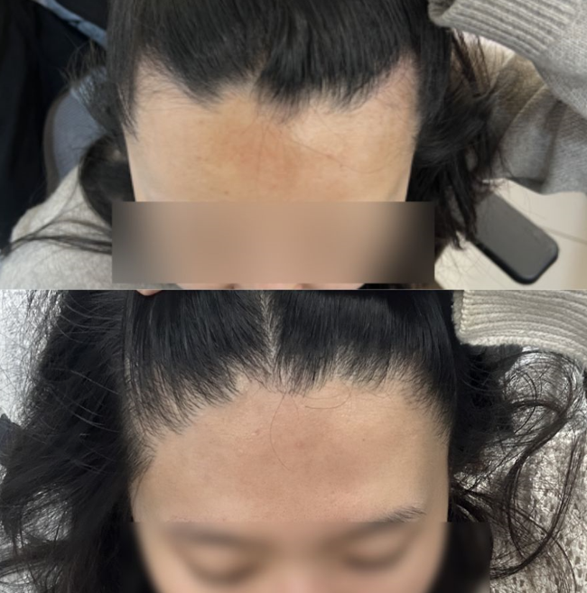 포토후기 이미지