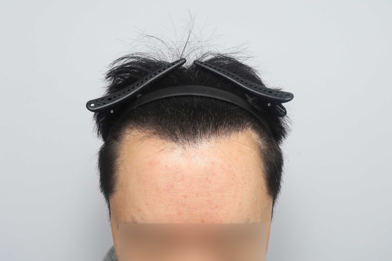 포토후기 이미지