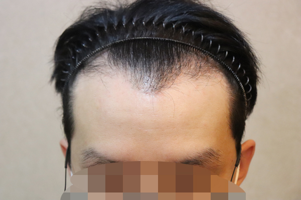 포토후기 이미지