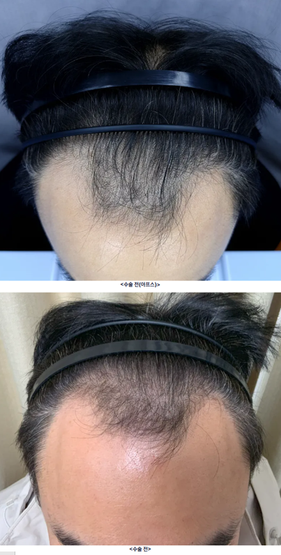 포토후기 이미지
