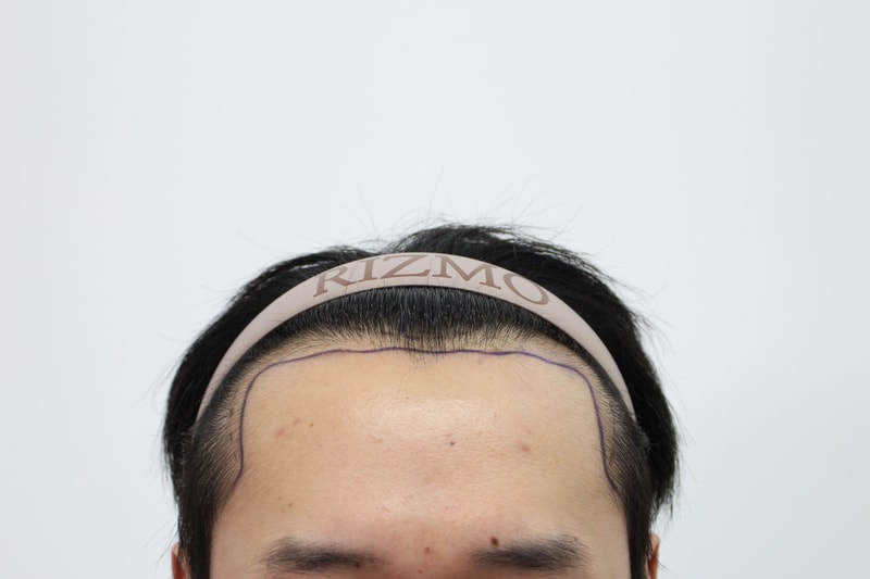 수술중1.jpg