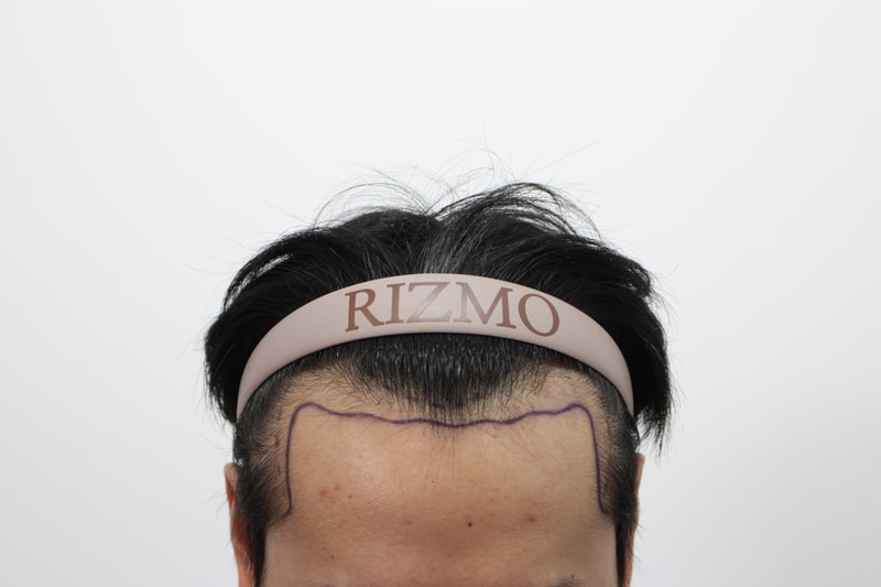 수술중2.jpg