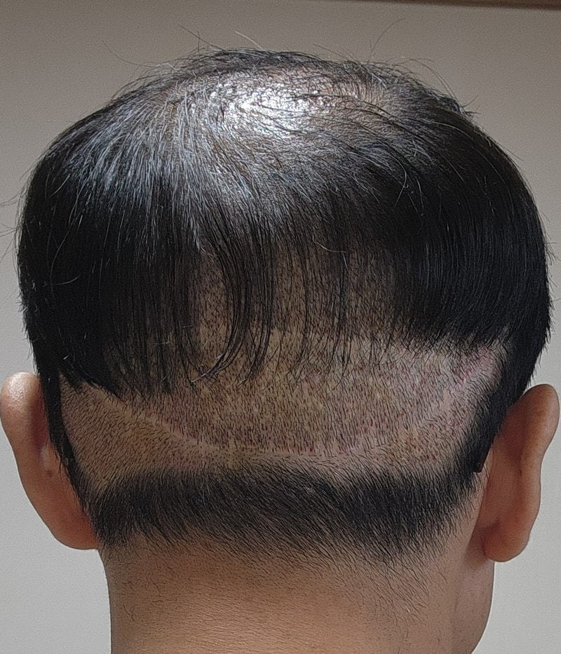 1000057806.jpg