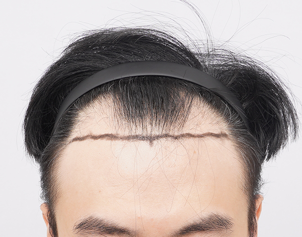포토후기 이미지