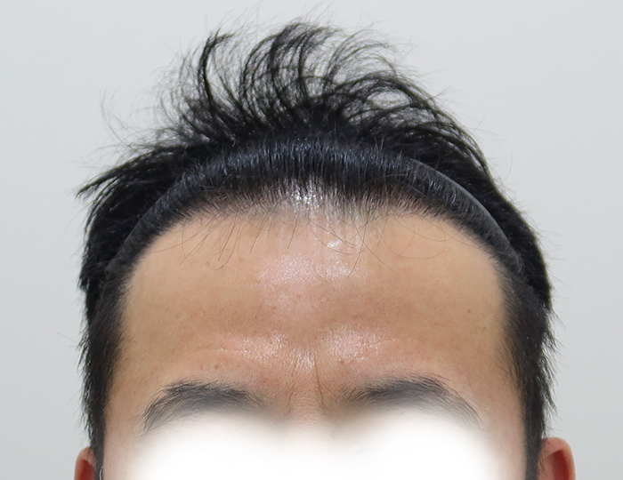 포토후기 이미지