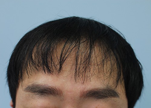 포토후기 이미지