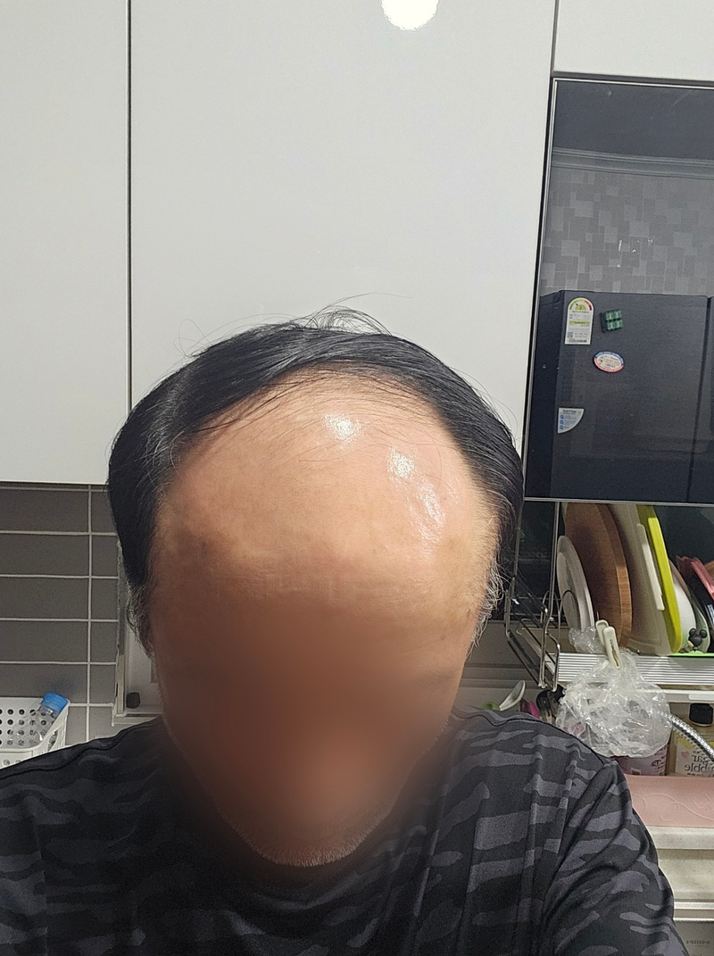 수술전_2.png