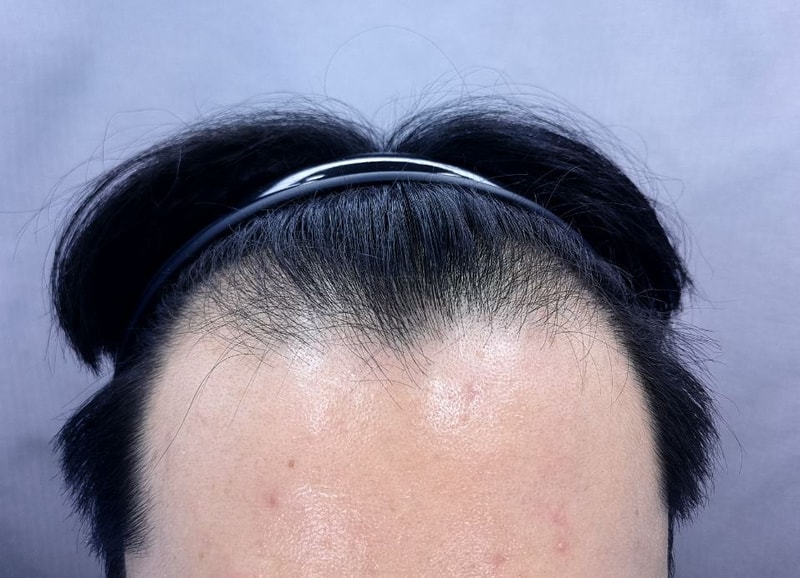 포토후기 이미지