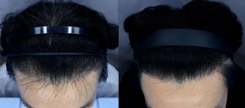 6mo-9mo.png