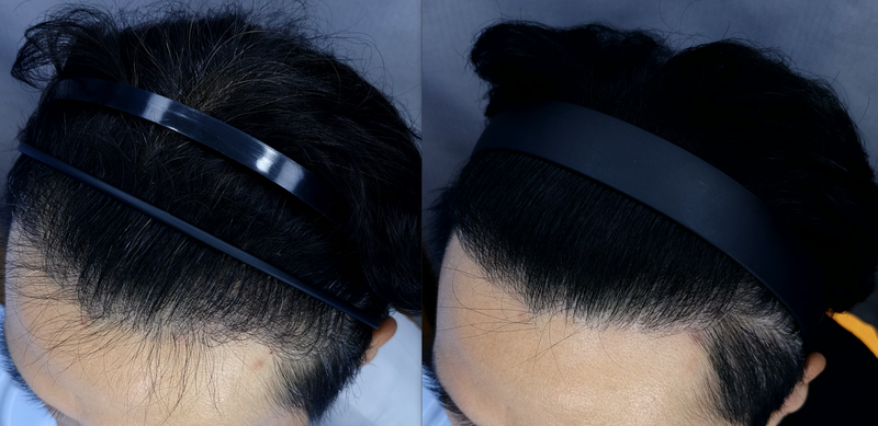 측면 6mo-9mo.png