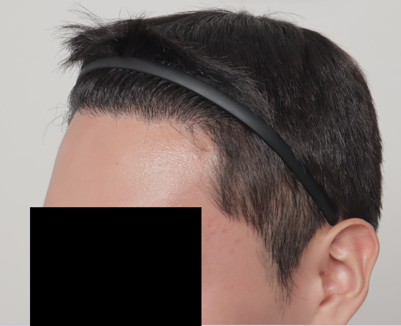 수술 1년차2.png