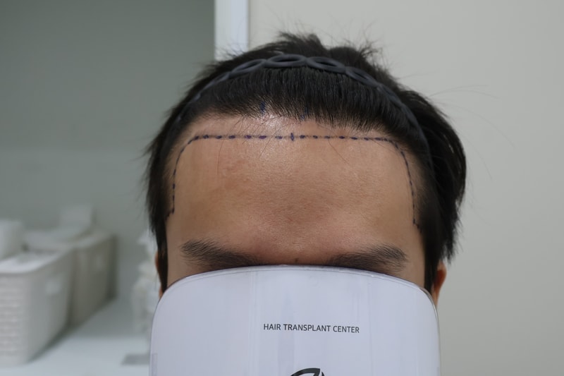 포토후기 이미지