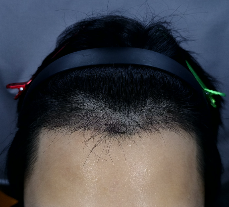 3mo 앞.png