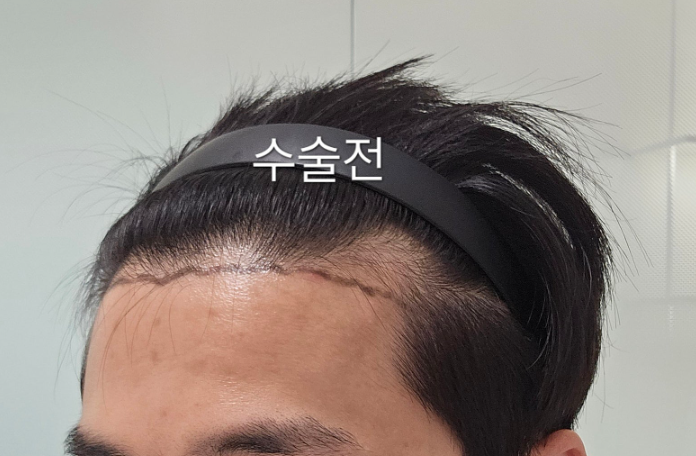 포토후기 이미지